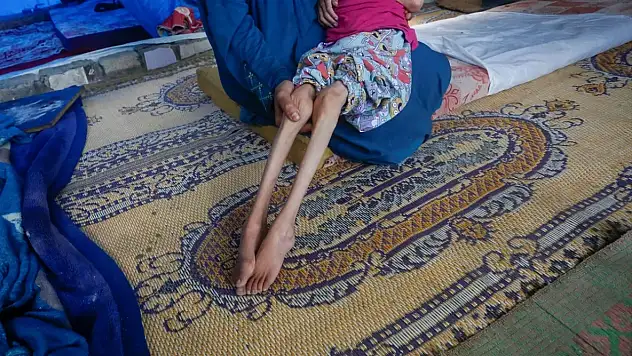 Gazze'de bebekler açlık yüzünden can veriyor!